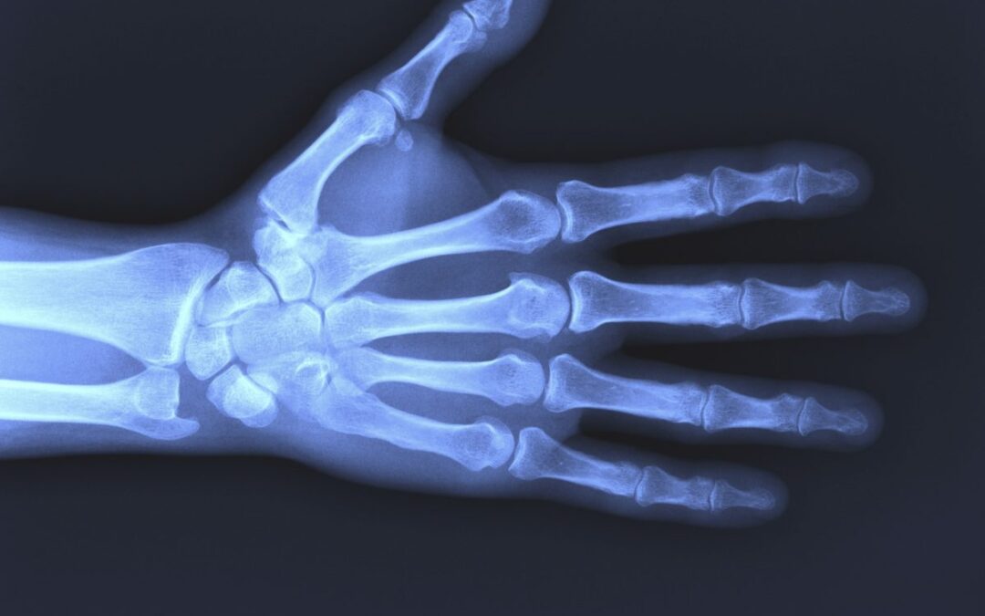 Servicio de Rayos X en Consultorios Santa Cruz San Luis de la Paz